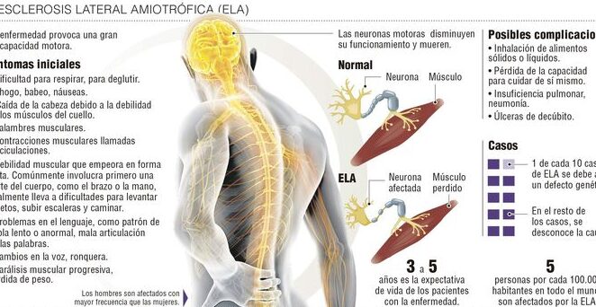 malestar al levantar el brazo de forma lateral