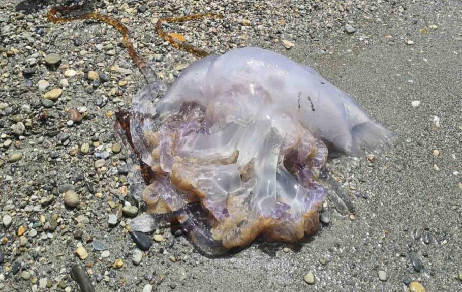 consejos para aliviar la picadura de medusa
